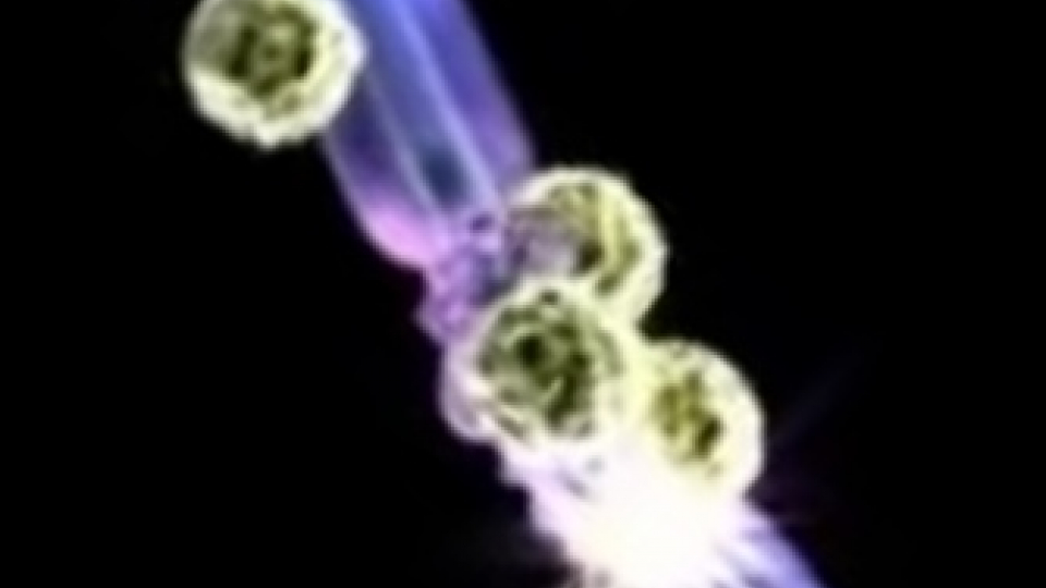 Attaque de la myéline des nerfs